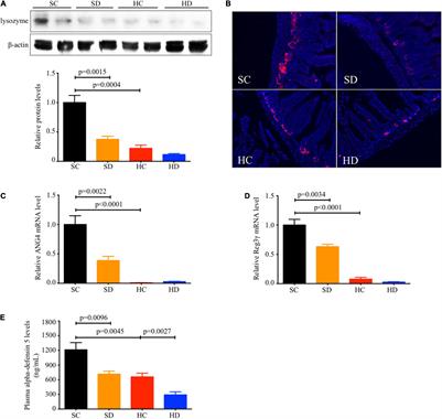 Alleviation of Hepatic Steatosis: Dithizone-Related Gut Microbiome Restoration During Paneth Cell Dysfunction